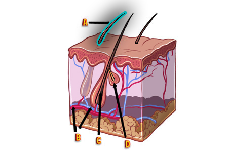 Cross section of human skin showing hair folicle and different parts.