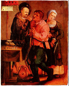 Painting of tooth extraction.